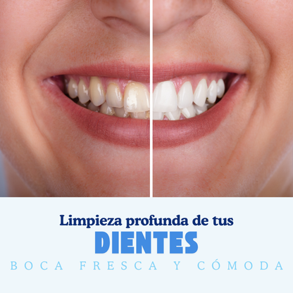 WhiteClean™ Cepillo Dental Inteligente